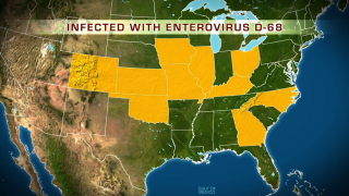 Illustration for article titled What You Need To Know About The Current Enterovirus Outbreak